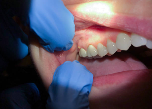 Best Dentist for Dental Trauma  in Rossville, GA