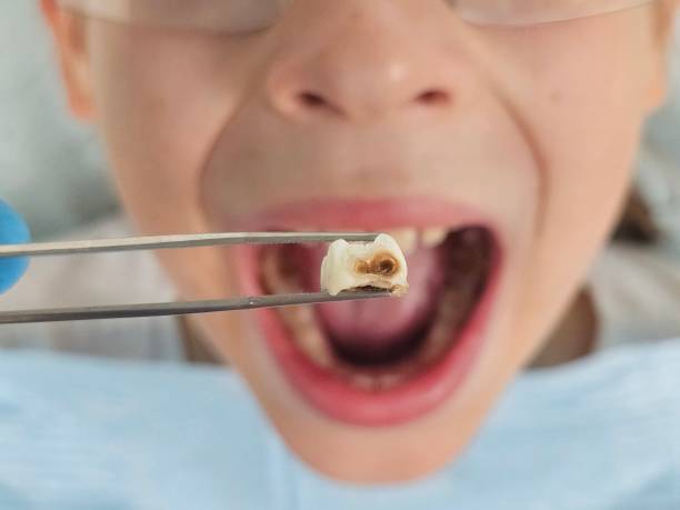 Best Emergency Dentist Near Me  in Rossville, GA