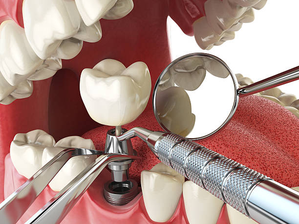 Best Emergency Dentist Open Today  in Rossville, GA